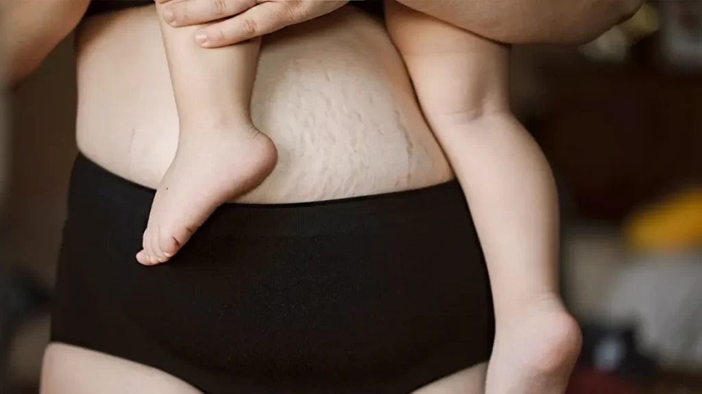 Want to Try Seamless Underwear: Why?